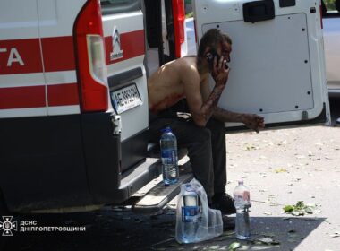 A man injured after the Russian strike on civilians in Dnipro on 24 June that killed at least one and injured over 20 people.